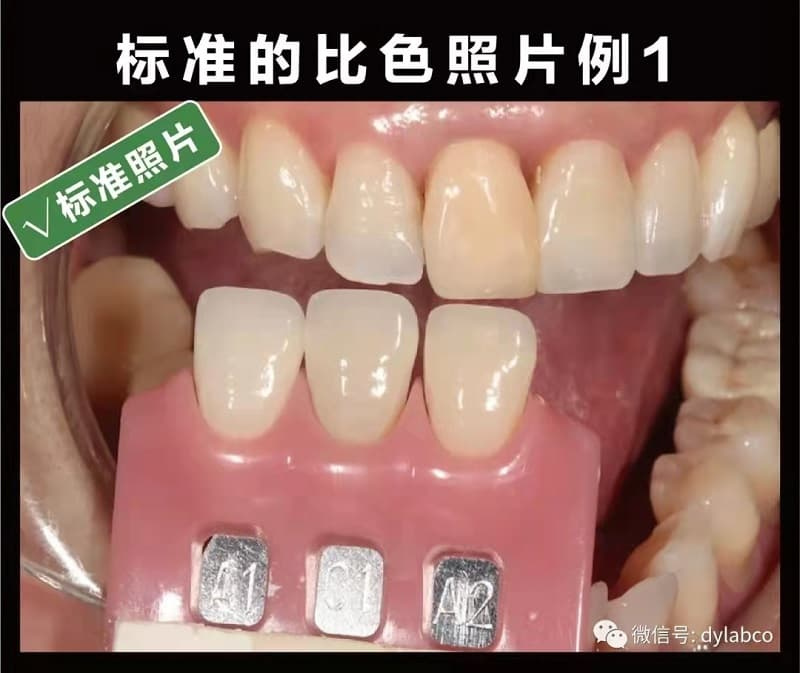 《醫(yī)技溝通篇》——技師需要什么樣的比色照片